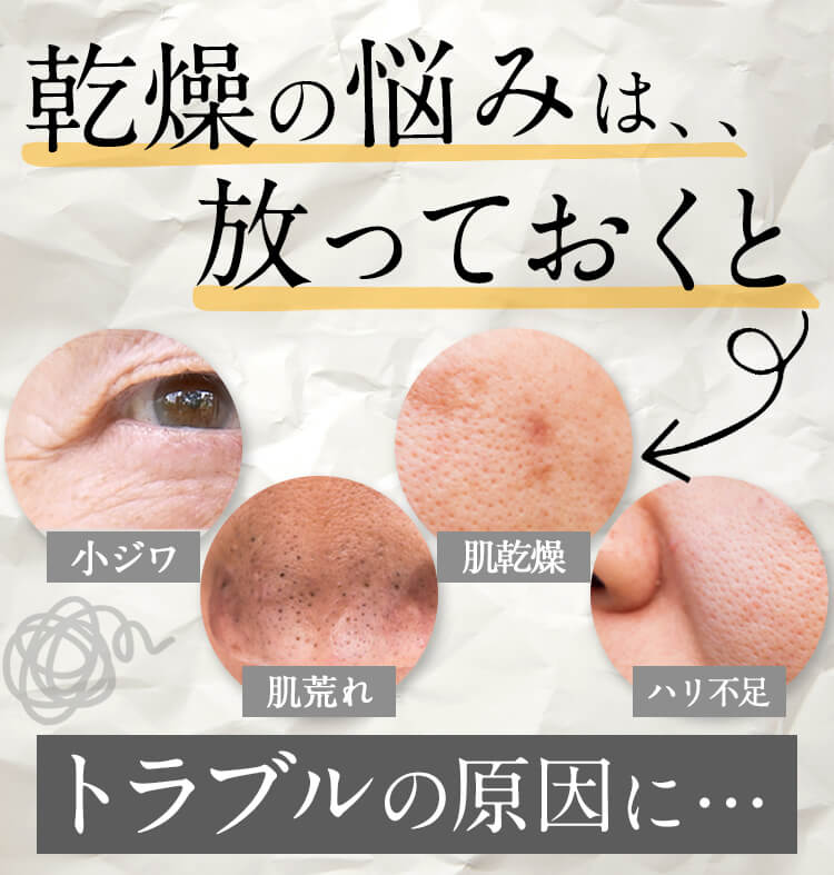 乾燥の悩み