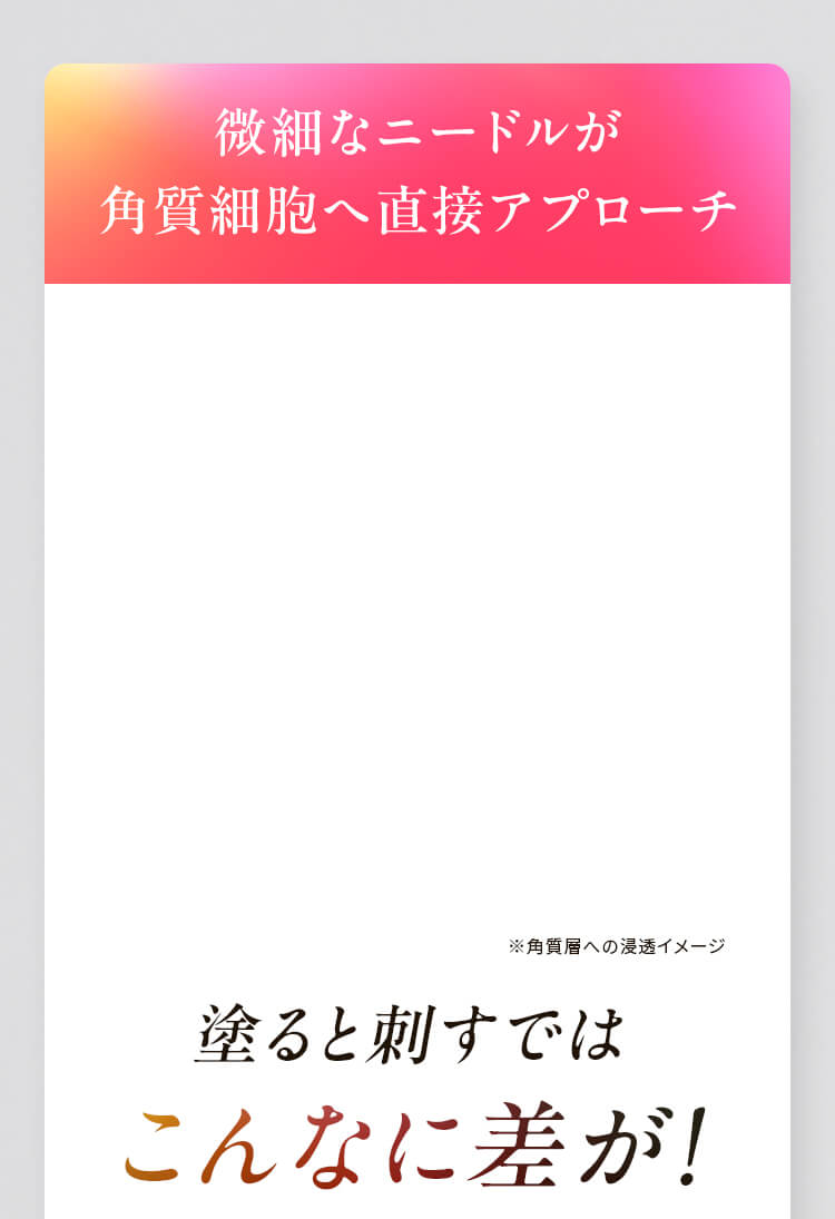 アプローチ1