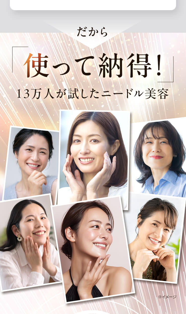同意事項
