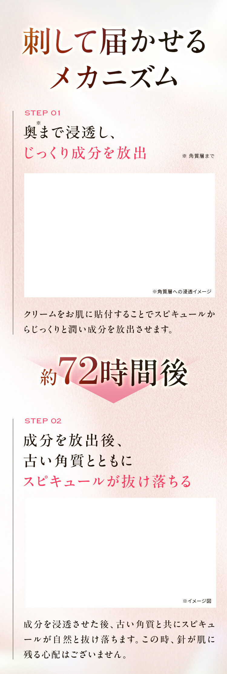 メカニズム