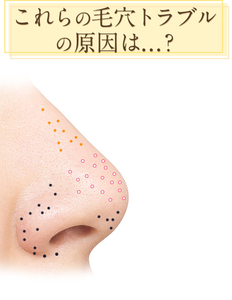 これらの毛穴トラブルの原因は…?