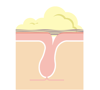 ハリと弾力のあるつるんとなめらか肌へ