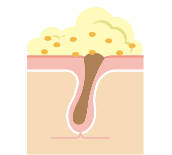 透明感あふれる素肌に